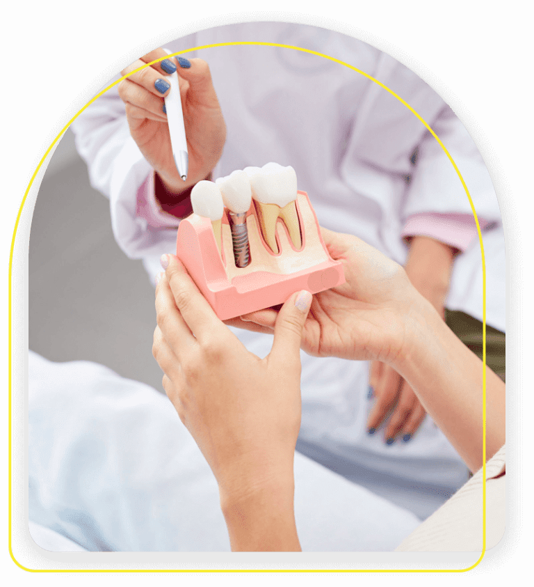 Dental Implant West Covina Dental